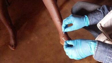 Mpox: What you need to know about the latest public health emergency